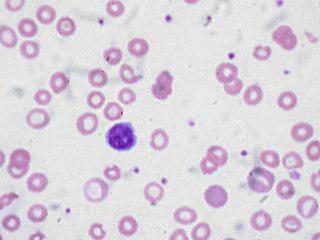 Белок, названный в честь бога металлургов, был открыт при изучении мышей, страдающих от нехватки железа. Фото 2 