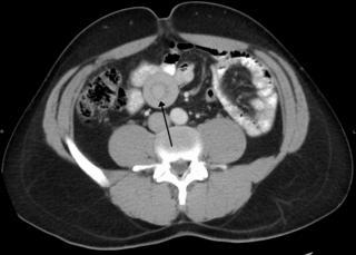 Кроме заворота кишок бывает и перекрут яичек. Фото 1