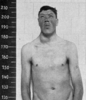 Освобождённый от службы в армии австрийский карлик к 30 годам превратился в гиганта. Фото 4 