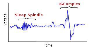 Сигма-ритм — один из основных и наиболее чётко выраженных элементов спонтанной ЭЭГ, зарегистрирован только у млекопитающих. У человека этот ритм возникает примерно с трёхмесячного возраста… Фото 2 