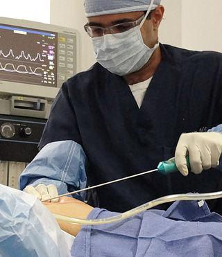 Желание вернуться в форму довело звезду Толливуда до могилы. Фото 1 